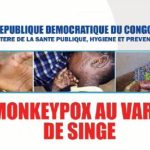 L'organisation mondiale de la santé alerte sur la propagation de l'épidémie de Monkey Pox